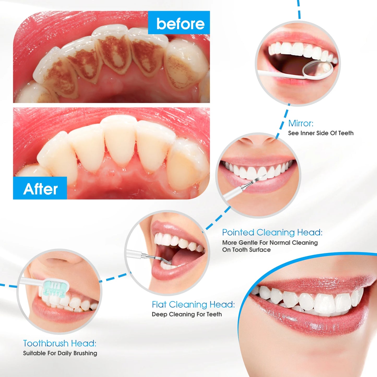 Ultrasonic Dental Scaler and Teeth Whitening Electric Toothbrush