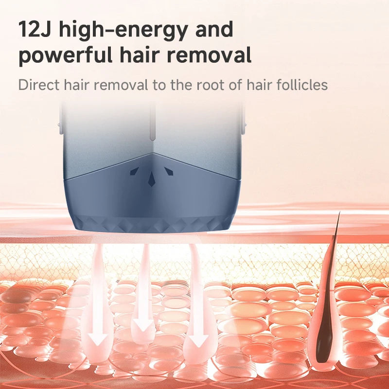 **IPL Ice Cooling Hair Removal Device with Unlimited Flashes**